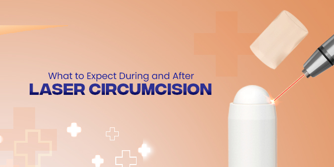 What to Expect During and After Laser Circumcision